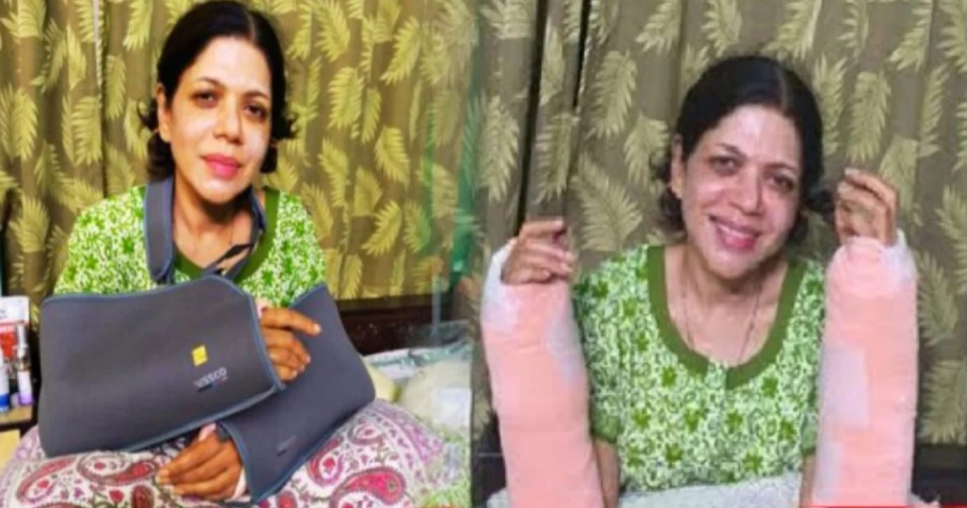 Nondinii Chatterjee, Bengali actress, hand injury, accident, actress hurt, operation, Hindi serial, Nayanatara serial, social media reaction, fracture, recovery, নন্দিনী চট্টোপাধ্যায়, বাঙালি অভিনেত্রী, হাত ভাঙা, দুর্ঘটনা, অভিনেত্রী আহত, অপারেশন, হিন্দি ধারাবাহিক, নয়নতারা, সমাজ মাধ্যমের প্রতিক্রিয়া, চোট, বিশ্রাম