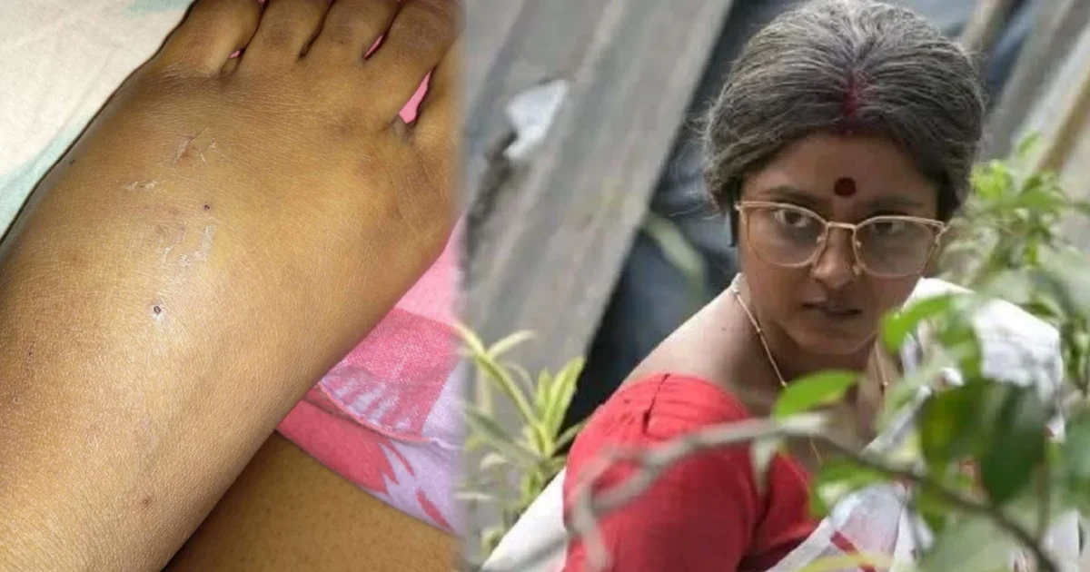 Shruti Das, Jowar Bhanta, Nisha Character, Online Trolling, Social Media Backlash, Running Scene, Physical Injury, Bike Accident, Television Actress, Bengali Serial, Bengali Television, শ্রুতি দাস, জোয়ার ভাঁটা, নিশা চরিত্র, ট্রোল, সমাজ মাধ্যমে কটাক্ষ, দৌড়ানোর দৃশ্য, শারীরিক সমস্যা, বাইক দুর্ঘটনা, ছোটপর্দার অভিনেত্রী, বাংলা টেলিভিশন, বাংলা ধারাবাহিক