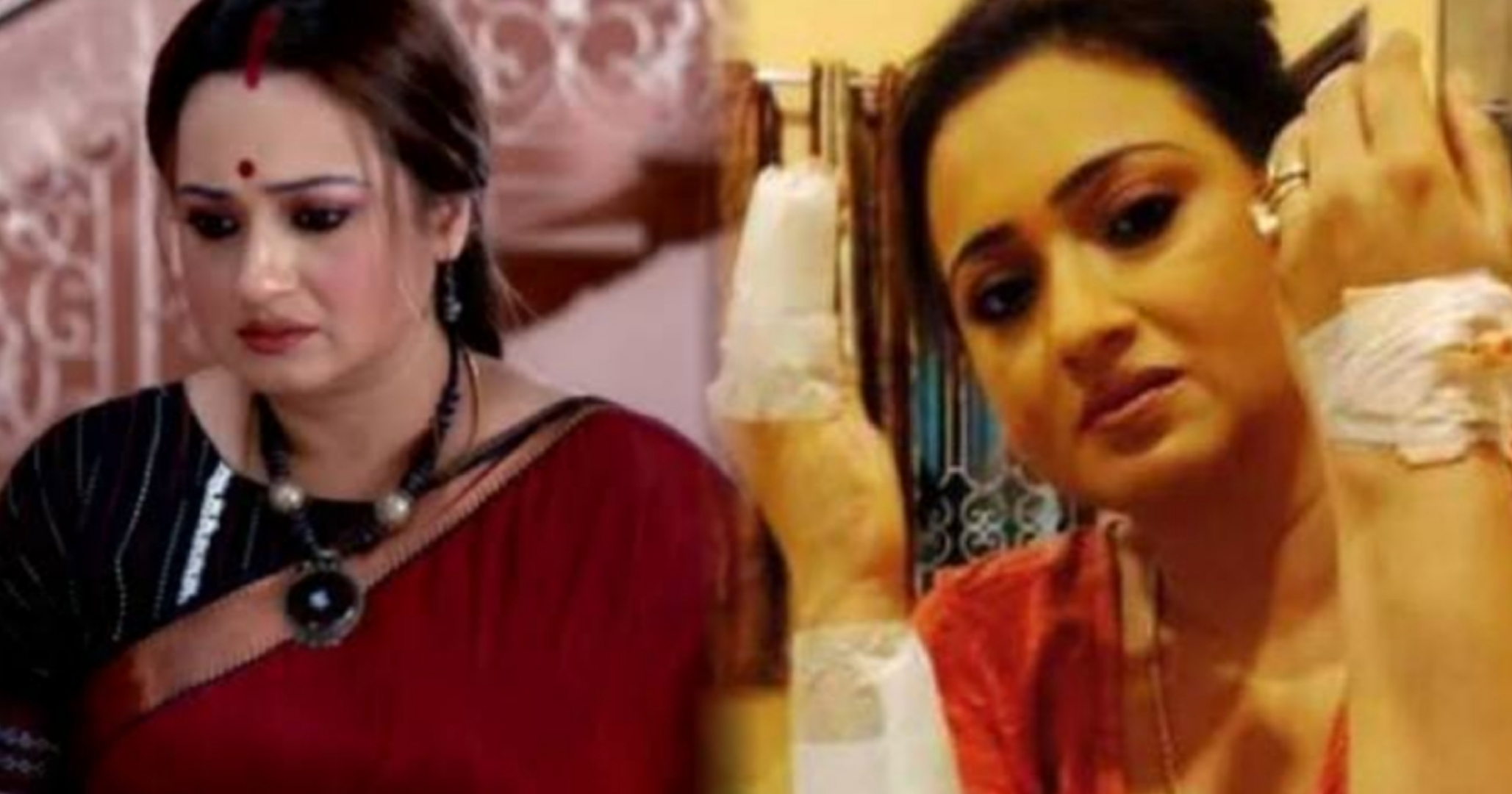 Swarnakamal Dutta, Swarnakamal Dutta accident, Bengali TV actress Swarnakamal, Swarnakamal Dutta injury, 18 stitches Swarnakamal, Shudhu Tomari Jonno serial, Bengali television news, Tollywood TV actress, actress injured during shooting, Bengali entertainment news, স্বর্ণকমল দত্ত, স্বর্ণকমল দুর্ঘটনা, স্বর্ণকমল দত্ত সেলাই, টেলিভিশন অভিনেত্রী স্বর্ণকমল, শুধু তোমারই জন্য ধারাবাহিক, বাংলা সিরিয়াল খবর, টলিউড টিভি অভিনেত্রী, দোলের আগে দুর্ঘটনা, শুটিংয়ে আহত অভিনেত্রী, বাংলা বিনোদন খবর