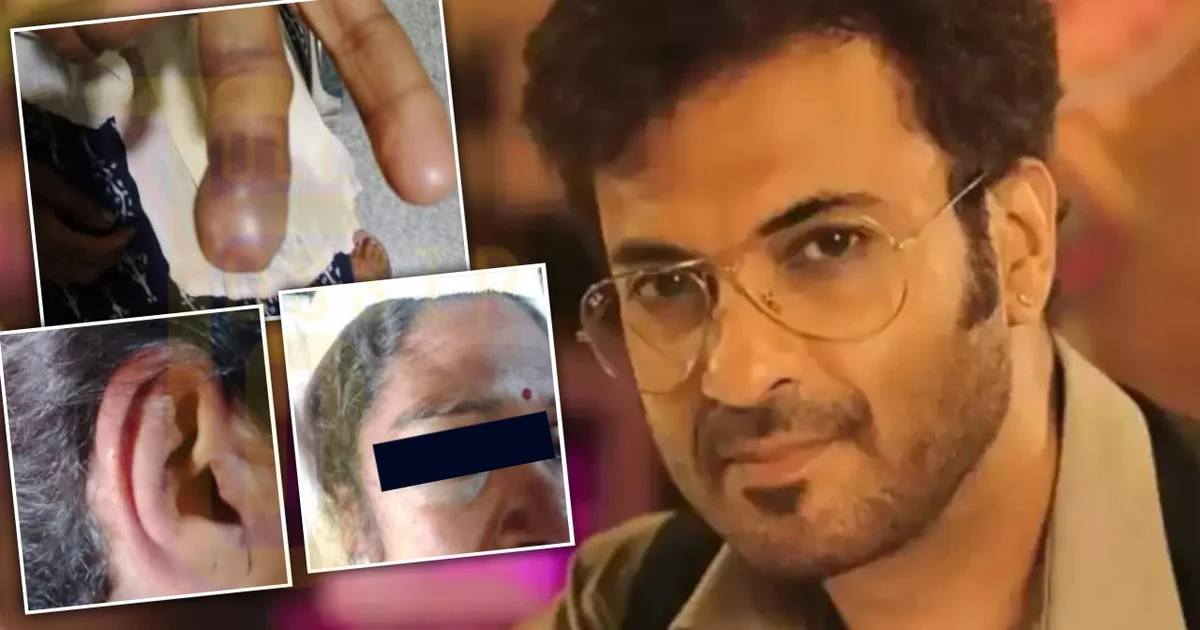 বাড়ির দারোয়ানকে ডেকে অ্যা'সিড আর লা'ঠি আনতে বলেন! আংটি চু'রির সন্দেহে ঘরে আটকে শারী'রিক নি'র্যাতন! অভিনেতা সম্রাট মুখার্জীর বিরুদ্ধে গৃহপরিচারিকাকে নৃ'শংস অ'ত্যাচারের অভিযোগ! টলিপাড়ায় নিন্দায় ছিঃ ছিঃ রব! 1 samrat mukherjee Assaulting Housemaid
