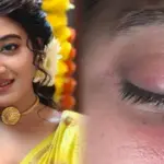 aratrika maity serious eye injury during shooting actress health update