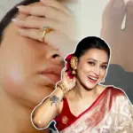 mimi chakraborty health update swollen face bandaged leg