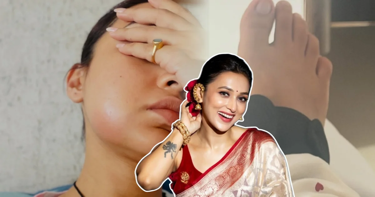 mimi chakraborty health update swollen face bandaged leg